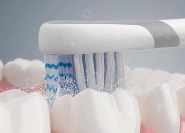 電動牙刷刷牙好嗎？真的比手動牙刷更好嗎？