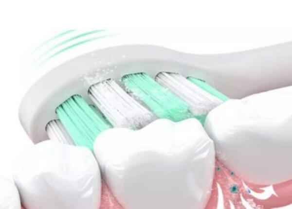 電動(dòng)牙刷選購(gòu)指南 電動(dòng)牙刷選購(gòu)指南